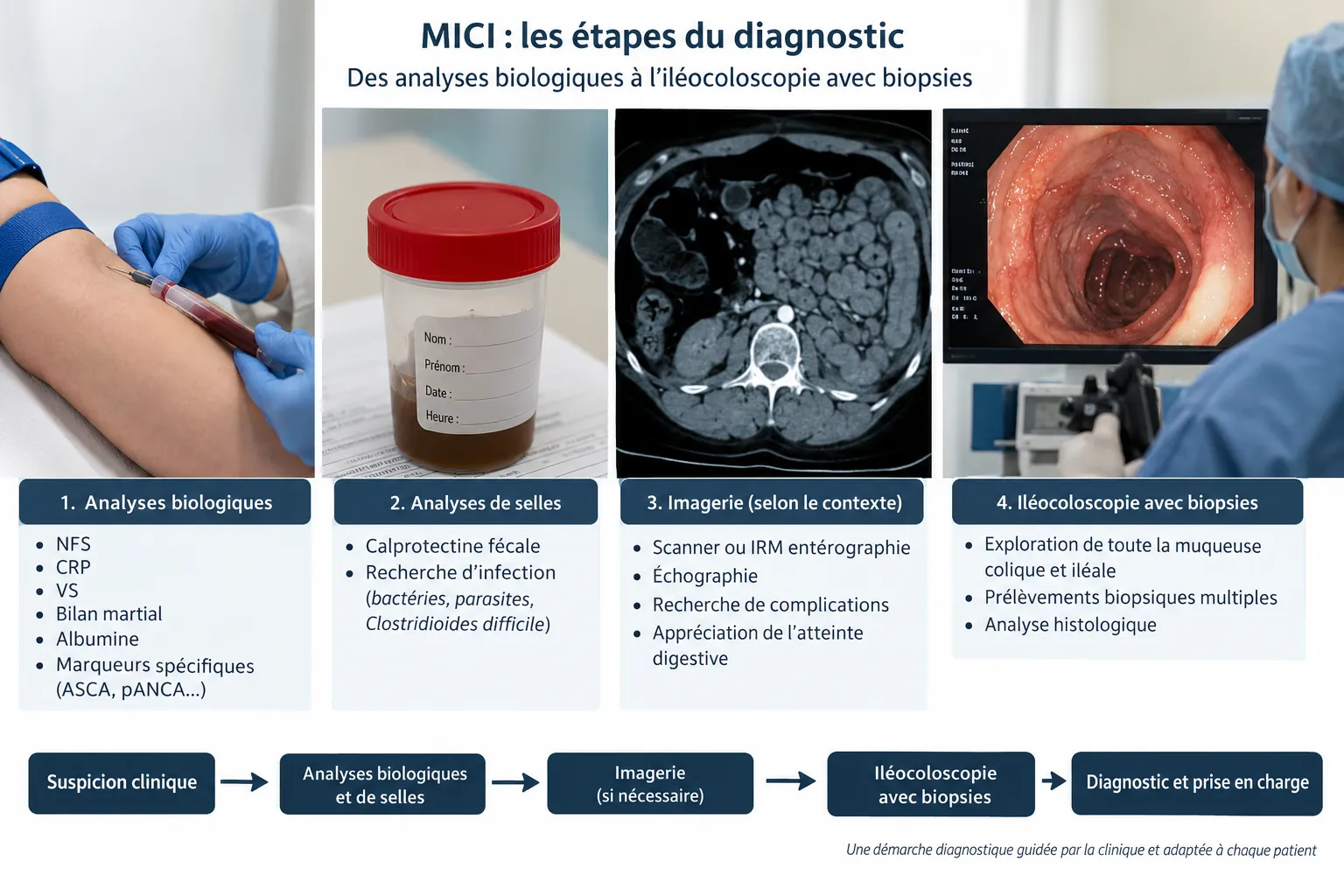 Une scène médicale montrant une préparation médicale et des instruments en lien avec le diagnostic des MICI.